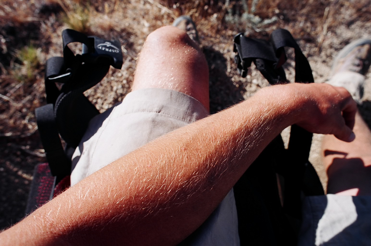 Sunburned and dirty.